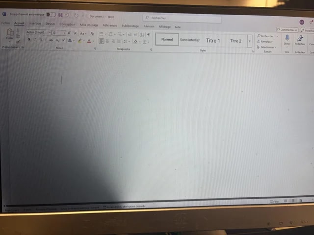 Common Signs of Screen Shadow: